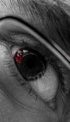 EYE