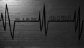 EKG