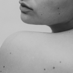 Dots